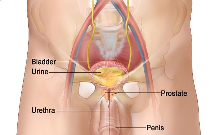 Kanker Prostat