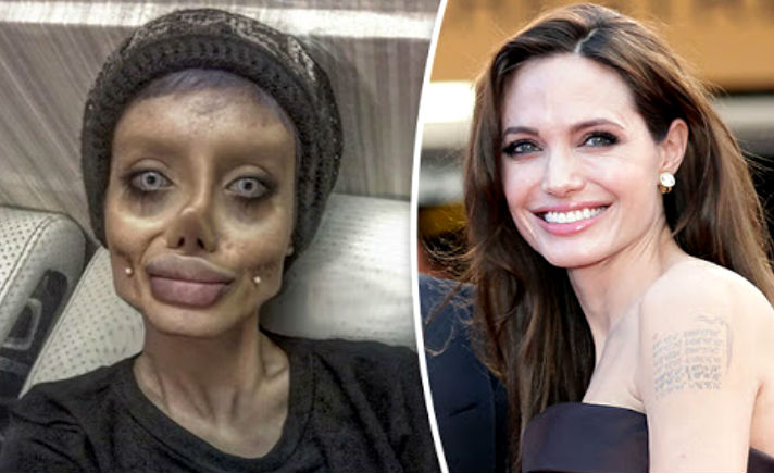 Agar Mirip Idola Tabar 50 Kali Operasi Plastik Agar Mirip Idola Tabar 50 Kali Operasi Plastik