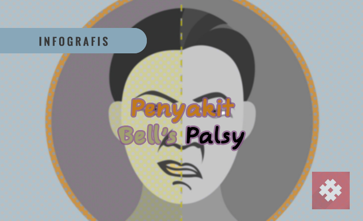 Bell's Palsy