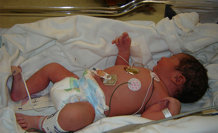 kanker leukimia