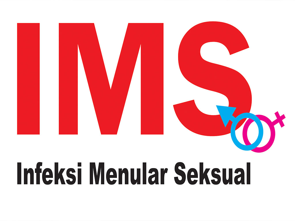 IMS
