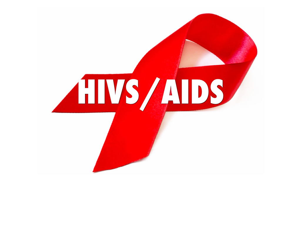 HIV AIDS