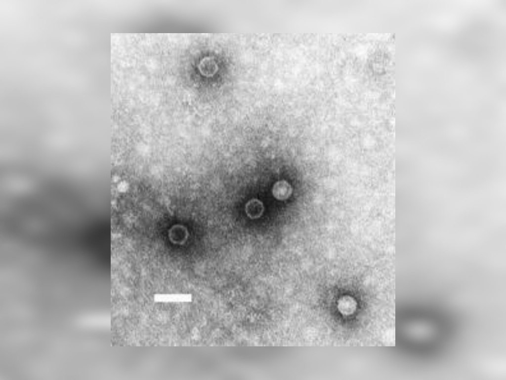 Polio