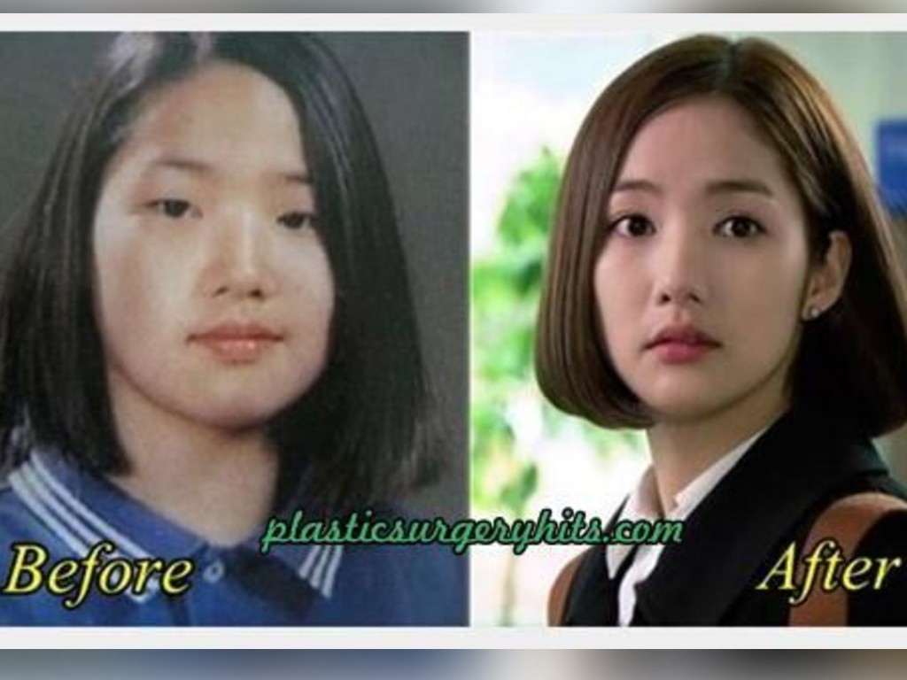 Park Min Young