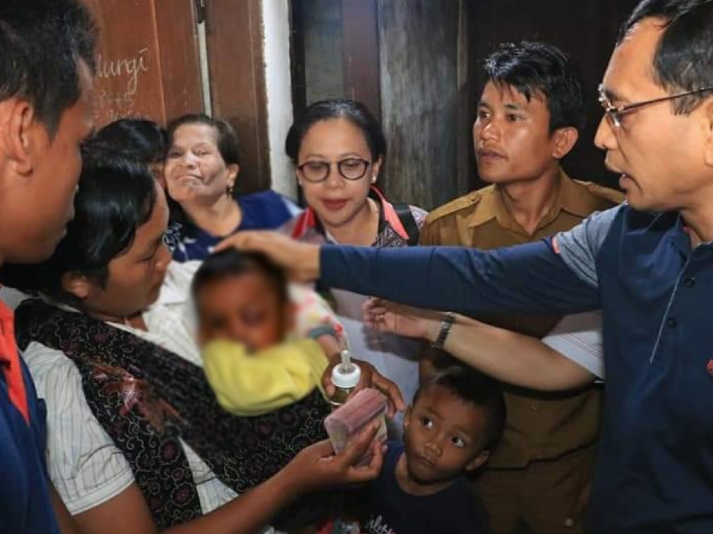 Penyakit Langka