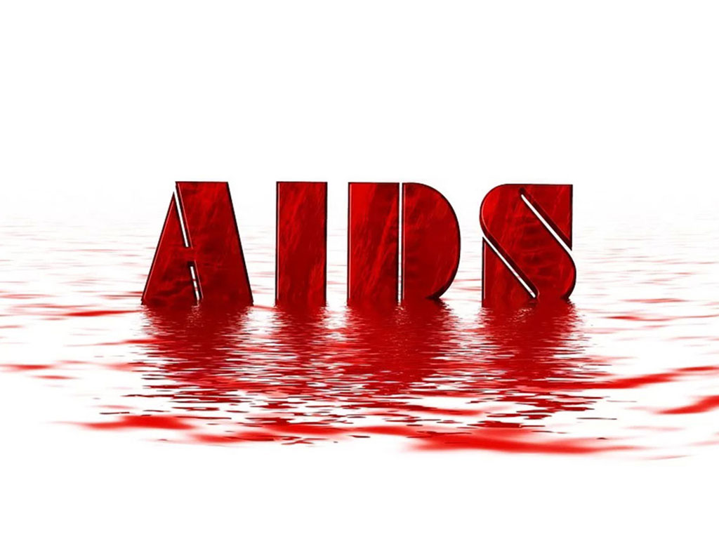 HIV AIDS