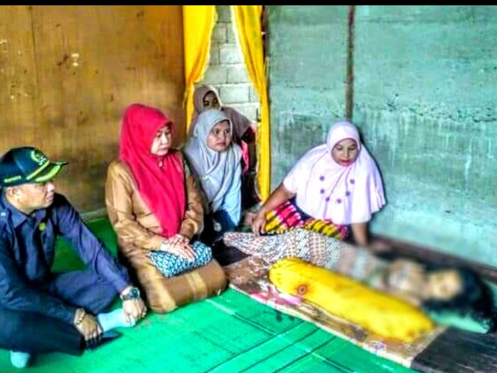 Bocah Penderita Tumor