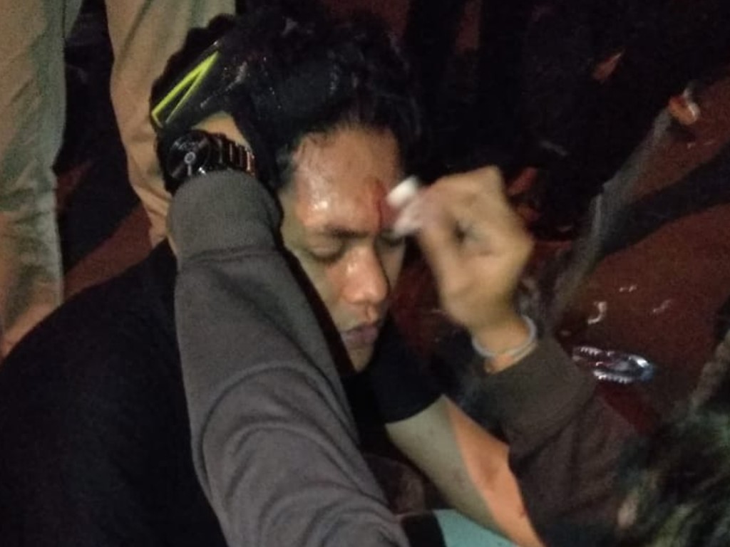 Peserta aksi terluka