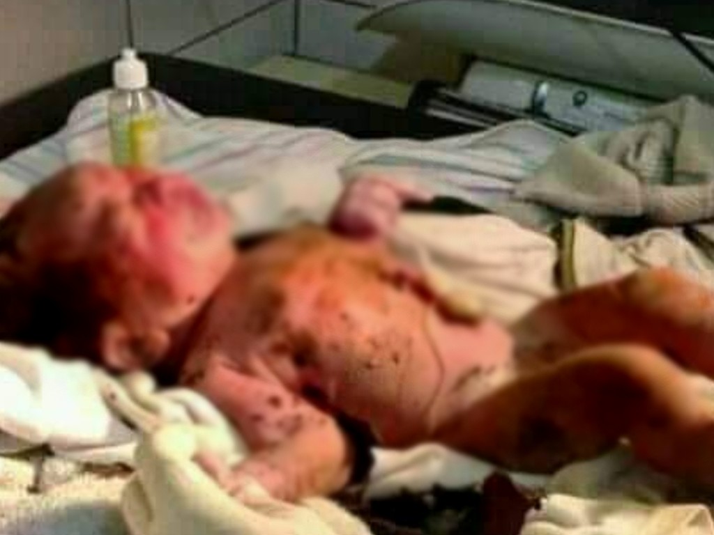 Penemuan Bayi Masih Hidup