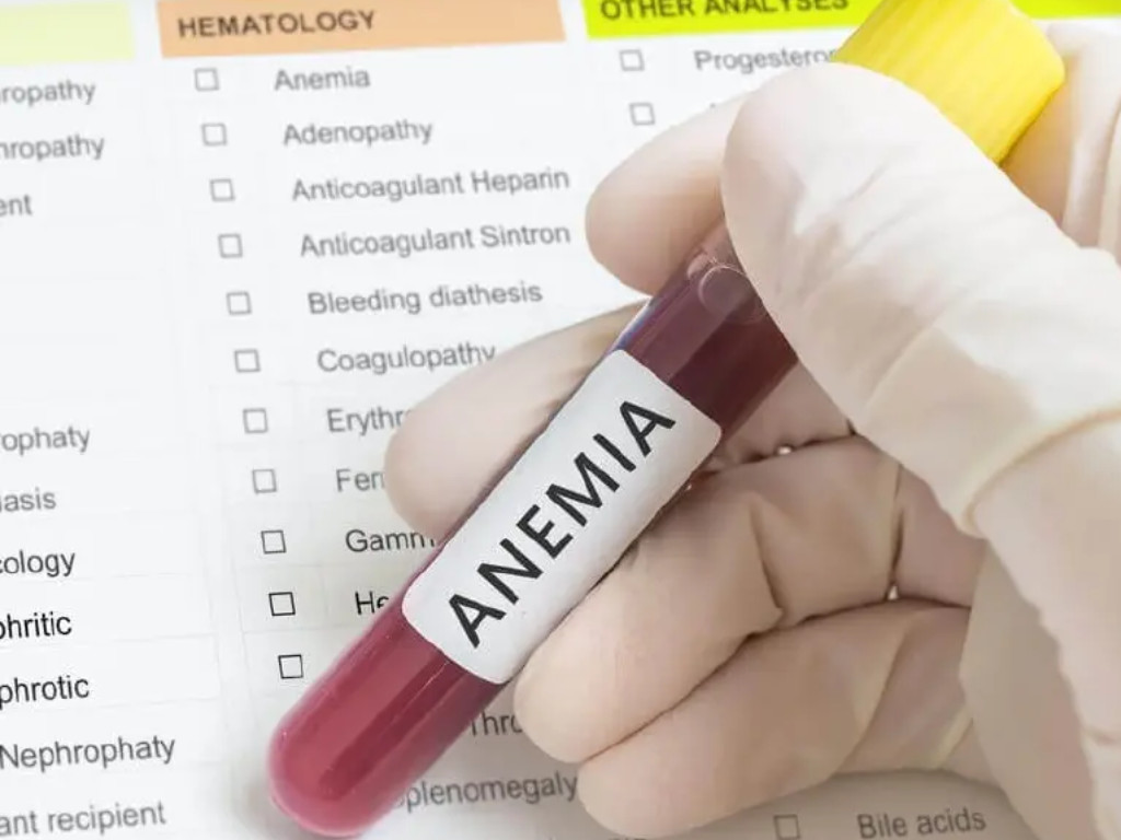 Anemia