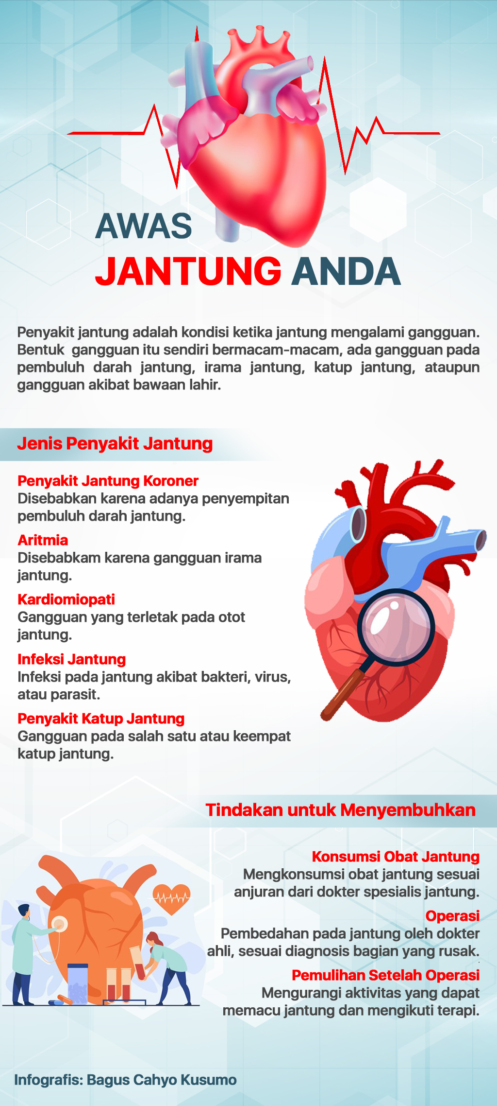 Lapsus Jantung Infografis