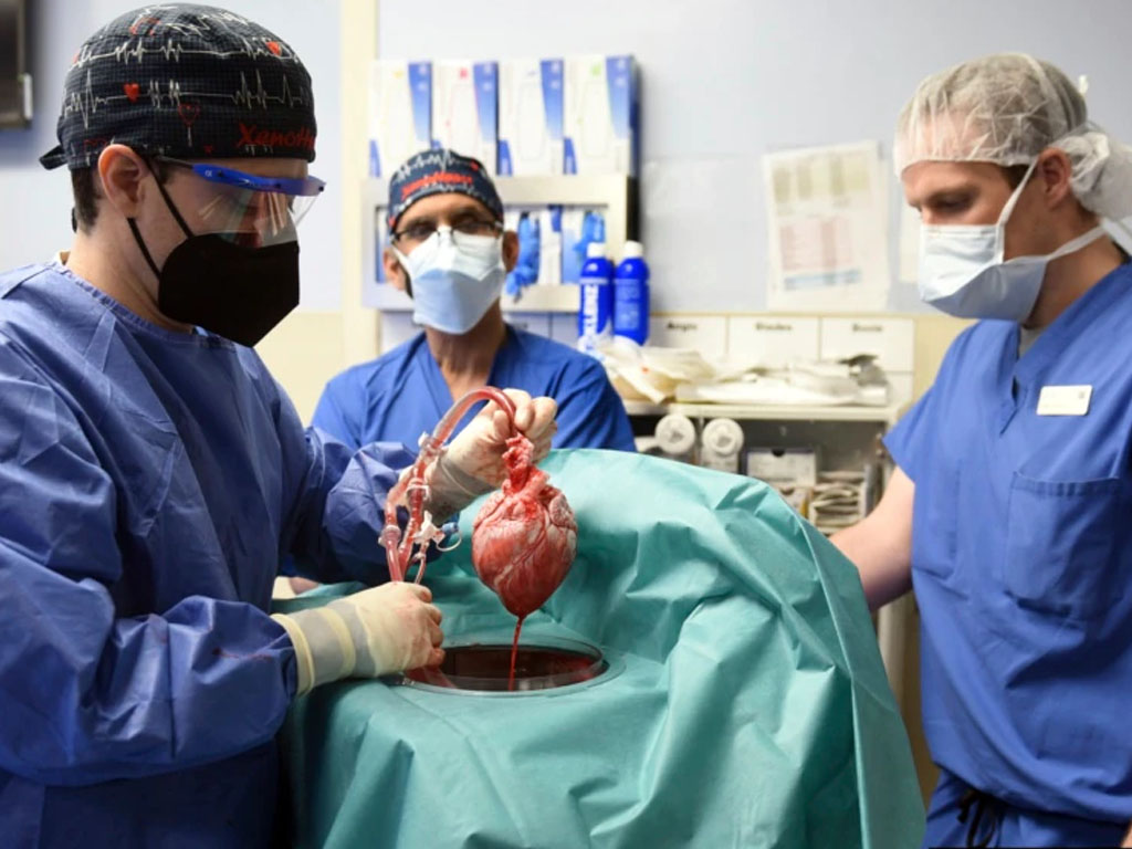 jantung babi transplantasi ke manusia