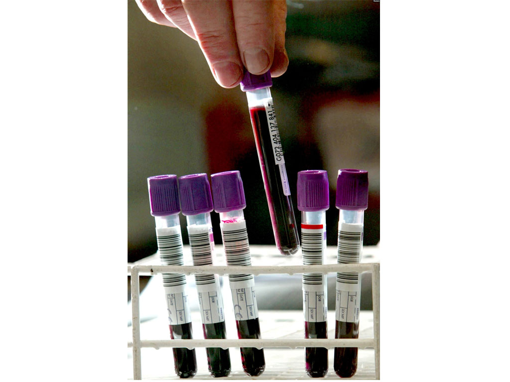 staf lab di london periksa sampel darah