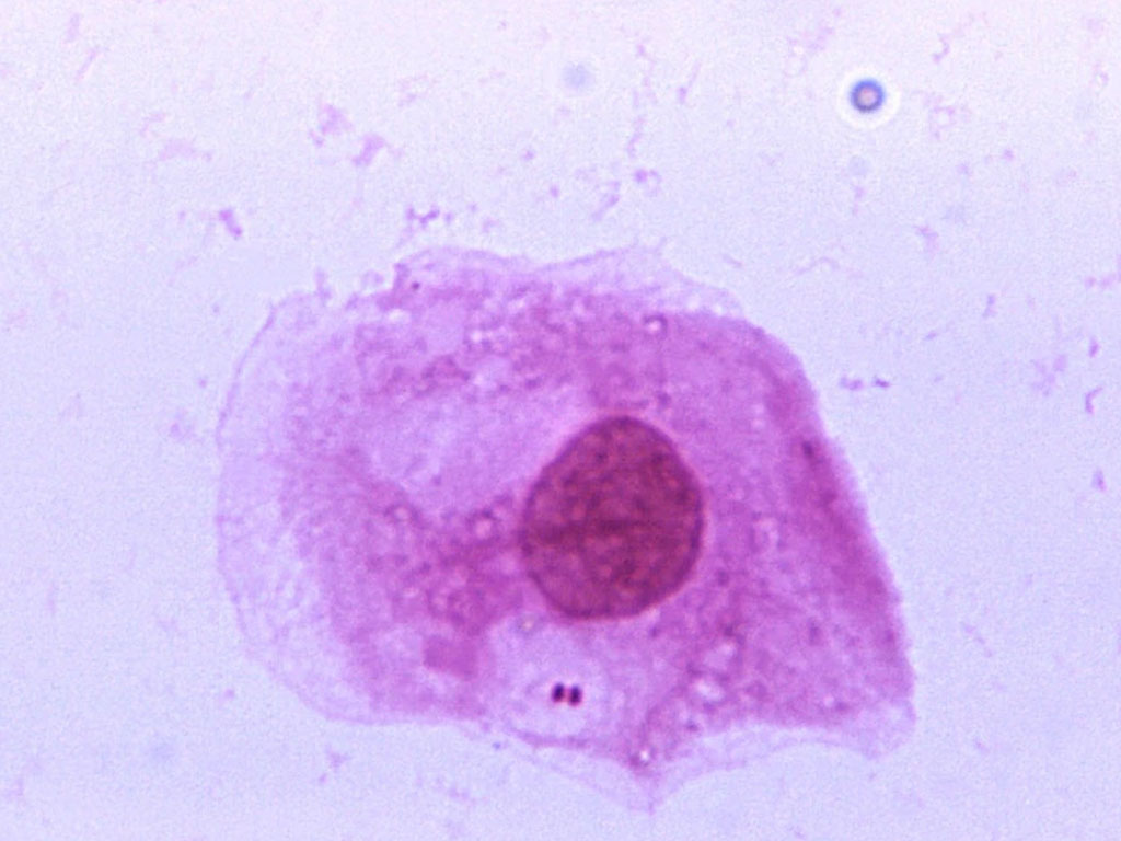 bakteri Neisseria