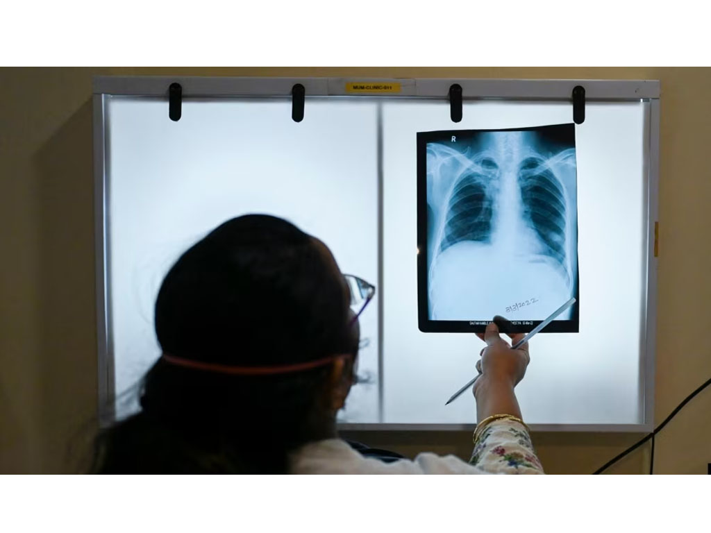 dokter periksa rontgen pasien di mumbai