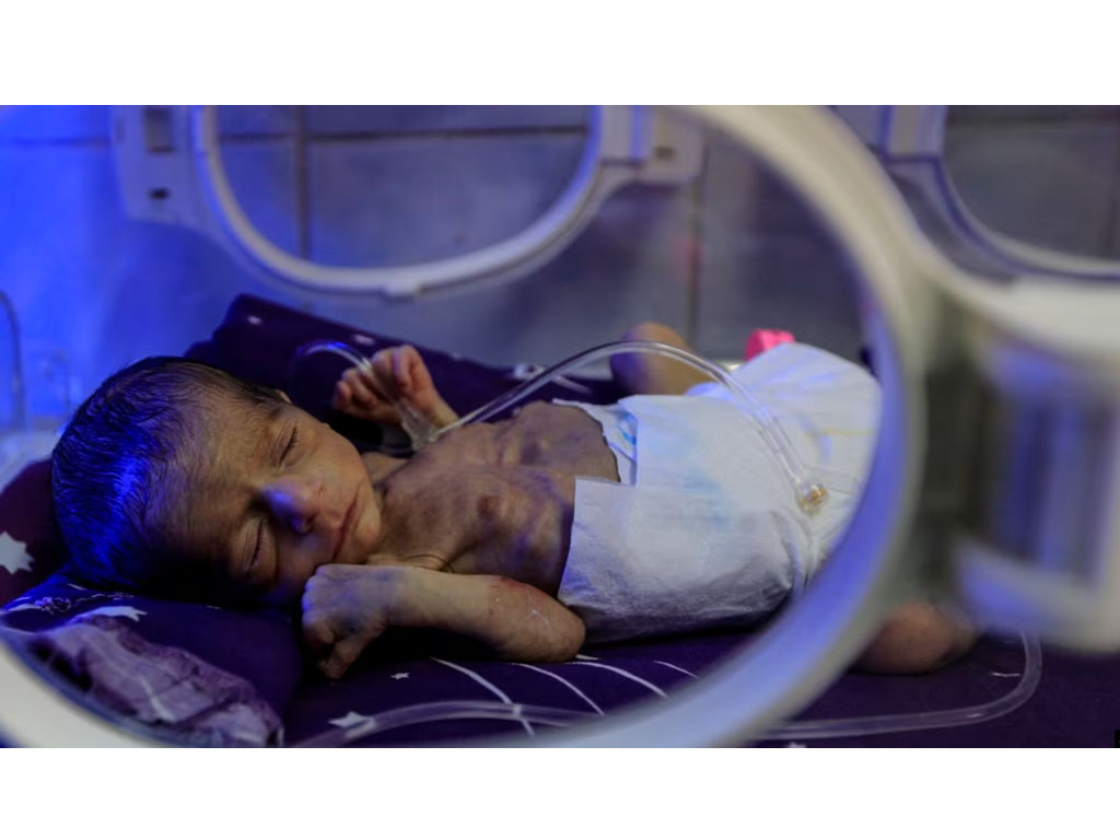 bayi prematur di yaman