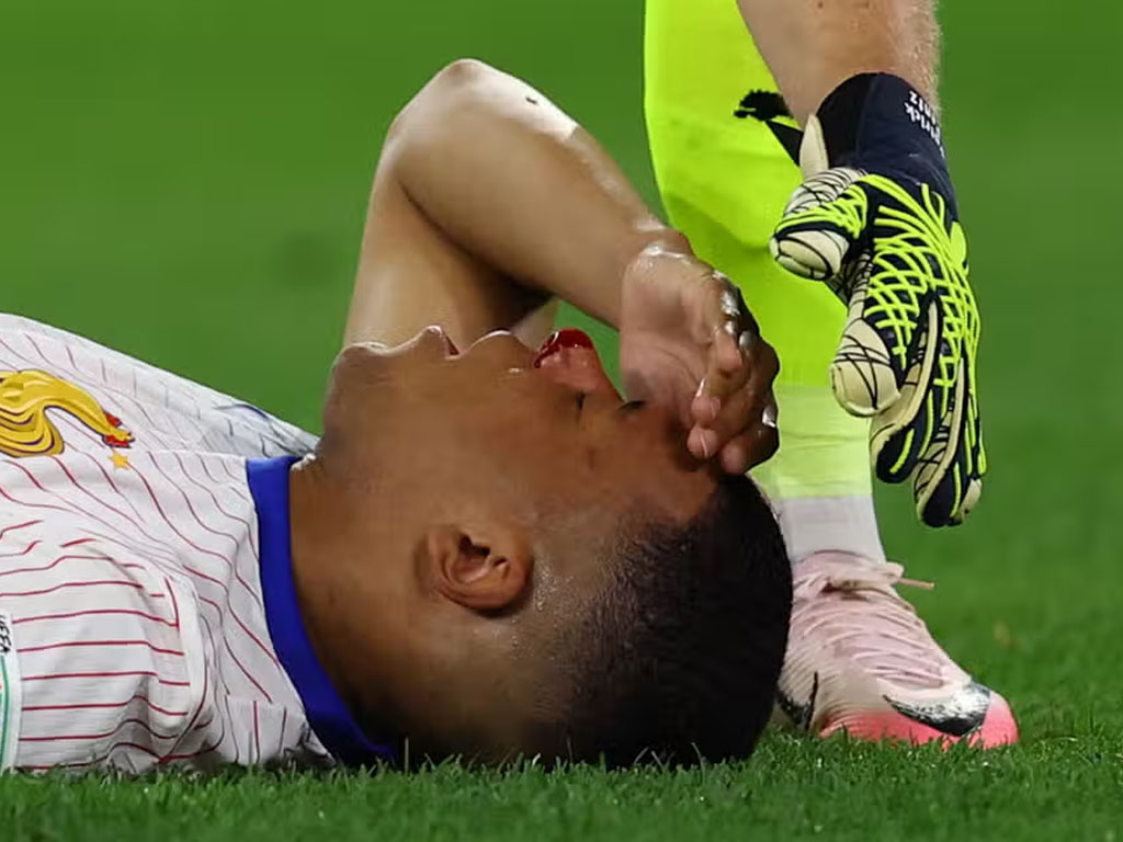Mbappe cedera