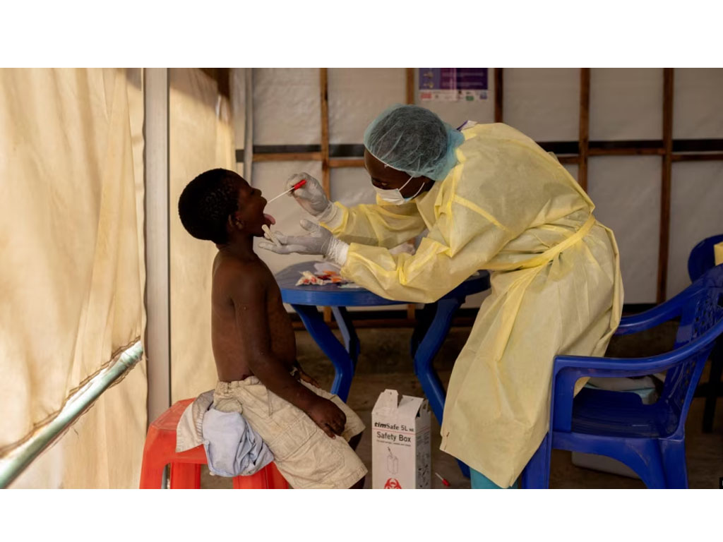 Nakes ambil sampel anak terduga mpox di afrika