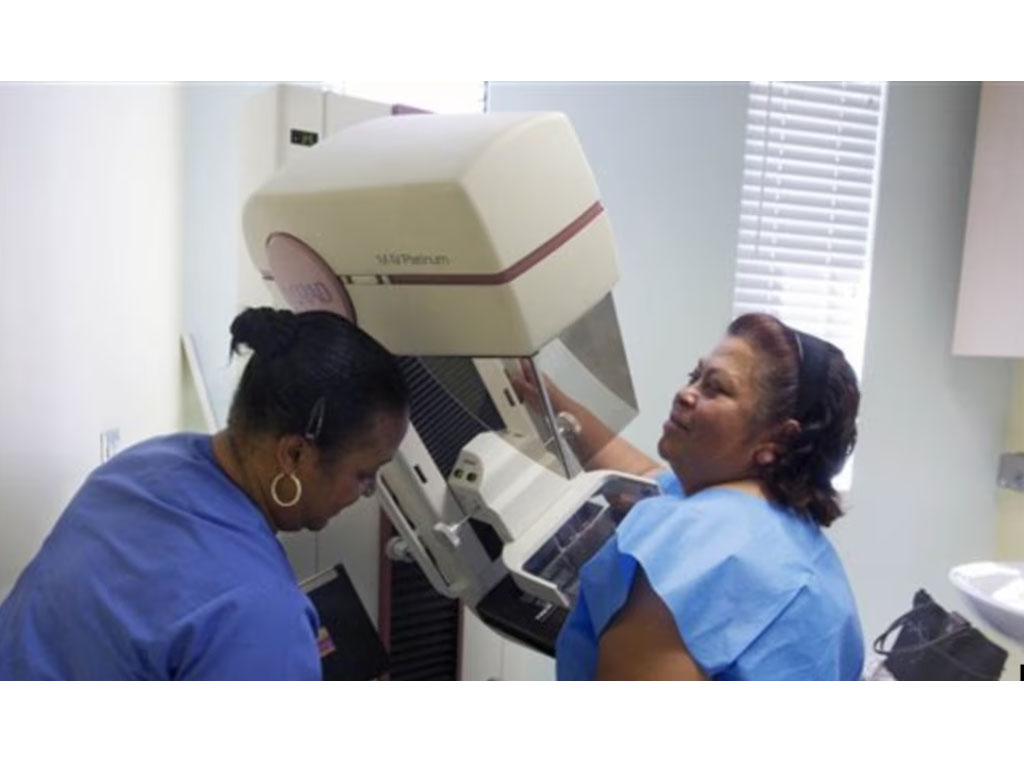 mamogram di California