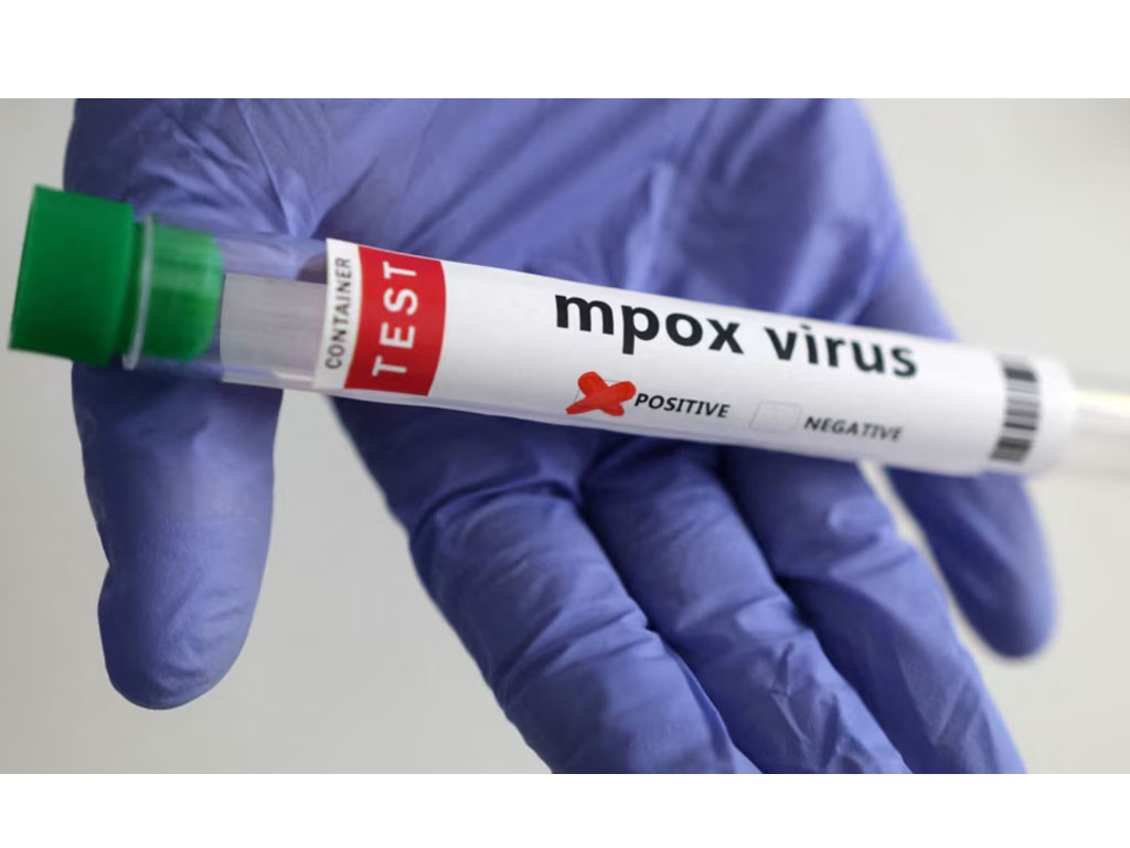 tabung tes Mpox