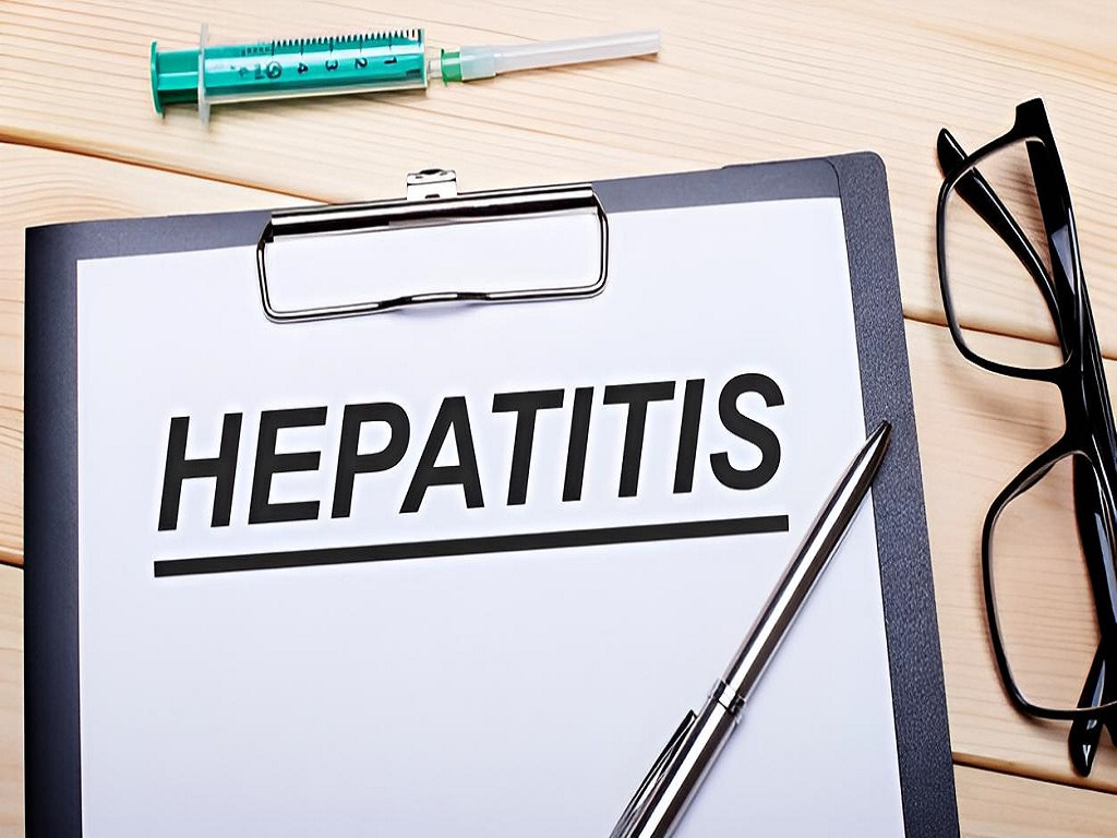 5 Faktor Penyebab Hepatitis, IDI Woha Bagikan Solusi Pengobatan